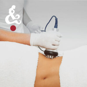 Essex and Hertfordshire book cheap Caviation Slimming and RF Treatment at home